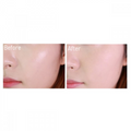 DR ALTHEA Dear.A Face Blur Finishing Powder (8g) before and afer